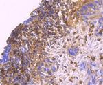 S100A9 Antibody in Immunohistochemistry (Paraffin) (IHC (P))