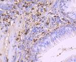 S100A9 Antibody in Immunohistochemistry (Paraffin) (IHC (P))