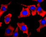 PDHA1 Antibody in Immunocytochemistry (ICC/IF)