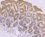 PDHA1 Antibody in Immunohistochemistry (Paraffin) (IHC (P))