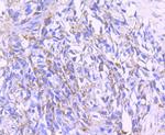 PDHA1 Antibody in Immunohistochemistry (Paraffin) (IHC (P))