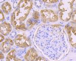 PDHA1 Antibody in Immunohistochemistry (Paraffin) (IHC (P))