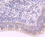 PDHA1 Antibody in Immunohistochemistry (Paraffin) (IHC (P))