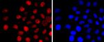 BCL11B Antibody in Immunocytochemistry (ICC/IF)