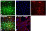 BCL11B Antibody in Immunocytochemistry (ICC/IF)