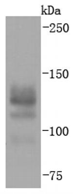 BCL11B Antibody in Western Blot (WB)