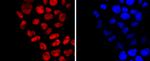 DNMT1 Antibody in Immunocytochemistry (ICC/IF)