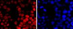 DNMT1 Antibody in Immunocytochemistry (ICC/IF)