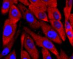 PGP9.5 Antibody in Immunocytochemistry (ICC/IF)