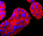 PGP9.5 Antibody in Immunocytochemistry (ICC/IF)