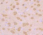 PGP9.5 Antibody in Immunohistochemistry (Paraffin) (IHC (P))