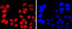 MiTF Antibody in Immunocytochemistry (ICC/IF)