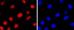 MiTF Antibody in Immunocytochemistry (ICC/IF)