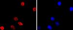 MiTF Antibody in Immunocytochemistry (ICC/IF)