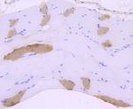 Myosin Heavy Chain Antibody in Immunohistochemistry (Paraffin) (IHC (P))