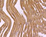 Myosin Heavy Chain Antibody in Immunohistochemistry (Paraffin) (IHC (P))