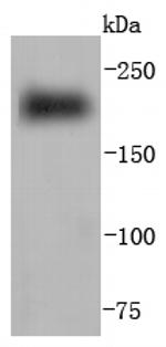 Myosin Heavy Chain Antibody in Western Blot (WB)