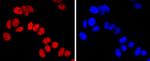 FOXA1 Antibody in Immunocytochemistry (ICC/IF)