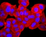 Pan Ras Antibody in Immunocytochemistry (ICC/IF)