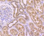 SERCA2 ATPase Antibody in Immunohistochemistry (Paraffin) (IHC (P))