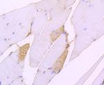 SERCA2 ATPase Antibody in Immunohistochemistry (Paraffin) (IHC (P))