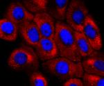 NUMB Antibody in Immunocytochemistry (ICC/IF)