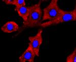 NUMB Antibody in Immunocytochemistry (ICC/IF)