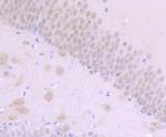 NUMB Antibody in Immunohistochemistry (Paraffin) (IHC (P))