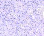 NUMB Antibody in Immunohistochemistry (Paraffin) (IHC (P))