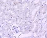 NUMB Antibody in Immunohistochemistry (Paraffin) (IHC (P))