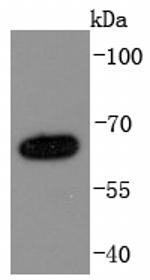 NUMB Antibody in Western Blot (WB)