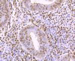 Thioredoxin 1 Antibody in Immunohistochemistry (Paraffin) (IHC (P))