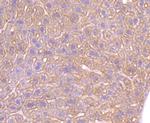 beta-2 Adrenergic Receptor Antibody in Immunohistochemistry (Paraffin) (IHC (P))