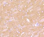 beta-2 Adrenergic Receptor Antibody in Immunohistochemistry (Paraffin) (IHC (P))