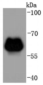 beta-2 Adrenergic Receptor Antibody in Western Blot (WB)