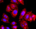 ADAM17 Antibody in Immunocytochemistry (ICC/IF)