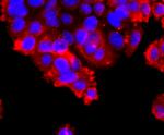 ADAM17 Antibody in Immunocytochemistry (ICC/IF)