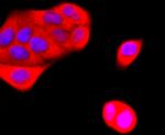 Ub-K63 Antibody in Immunocytochemistry (ICC/IF)