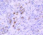 Ub-K63 Antibody in Immunohistochemistry (Paraffin) (IHC (P))