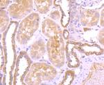 GC Antibody in Immunohistochemistry (Paraffin) (IHC (P))