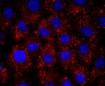 ERCC1 Antibody in Immunocytochemistry (ICC/IF)