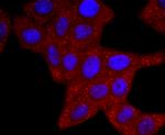 ERCC1 Antibody in Immunocytochemistry (ICC/IF)