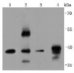 ERCC1 Antibody in Western Blot (WB)