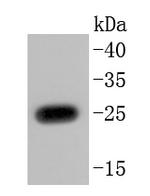 PGP9.5 Antibody in Western Blot (WB)