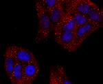 Haptoglobin Antibody in Immunocytochemistry (ICC/IF)