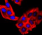 S1P1 Antibody in Immunocytochemistry (ICC/IF)