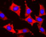 S1P1 Antibody in Immunocytochemistry (ICC/IF)