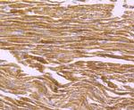 ATP Synthase beta Antibody in Immunohistochemistry (Paraffin) (IHC (P))