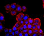 Aquaporin 1 Antibody in Immunocytochemistry (ICC/IF)