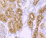 Aquaporin 1 Antibody in Immunohistochemistry (Paraffin) (IHC (P))